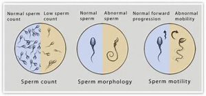 Seminal Uid Analysis Seminal Fluid Analysis(SFA) – CSHW
